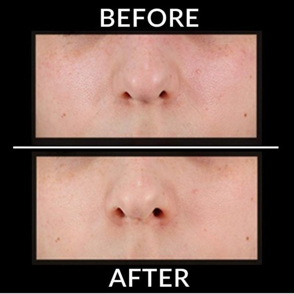 Clarisonic Mia Smart 3-in-1 App Connected Sonic Cleansing Device - WHITE - Picture 11 of 17